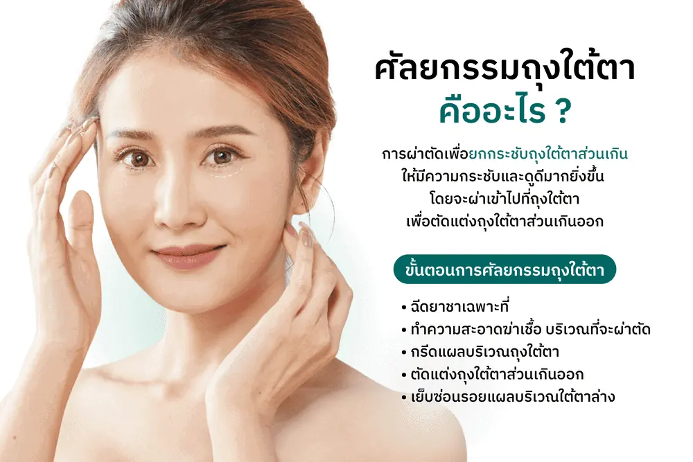 ขั้นตอนศัลยกรรมถุงใต้ตา