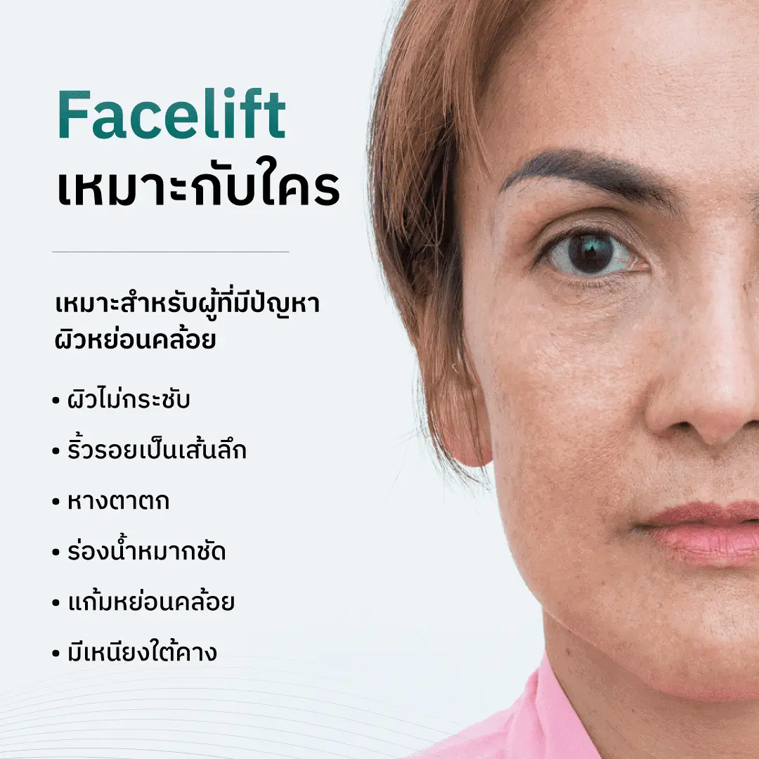 ยกกระชับใบหน้า Face lift เหมาะกับใครบ้าง?