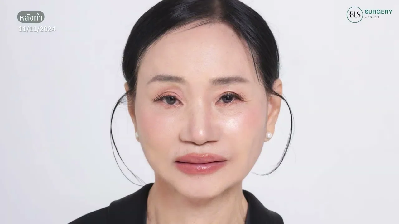 กลับไปเป็นตัวเองที่สดใสอีกครั้ง ในวัย 73 ปี