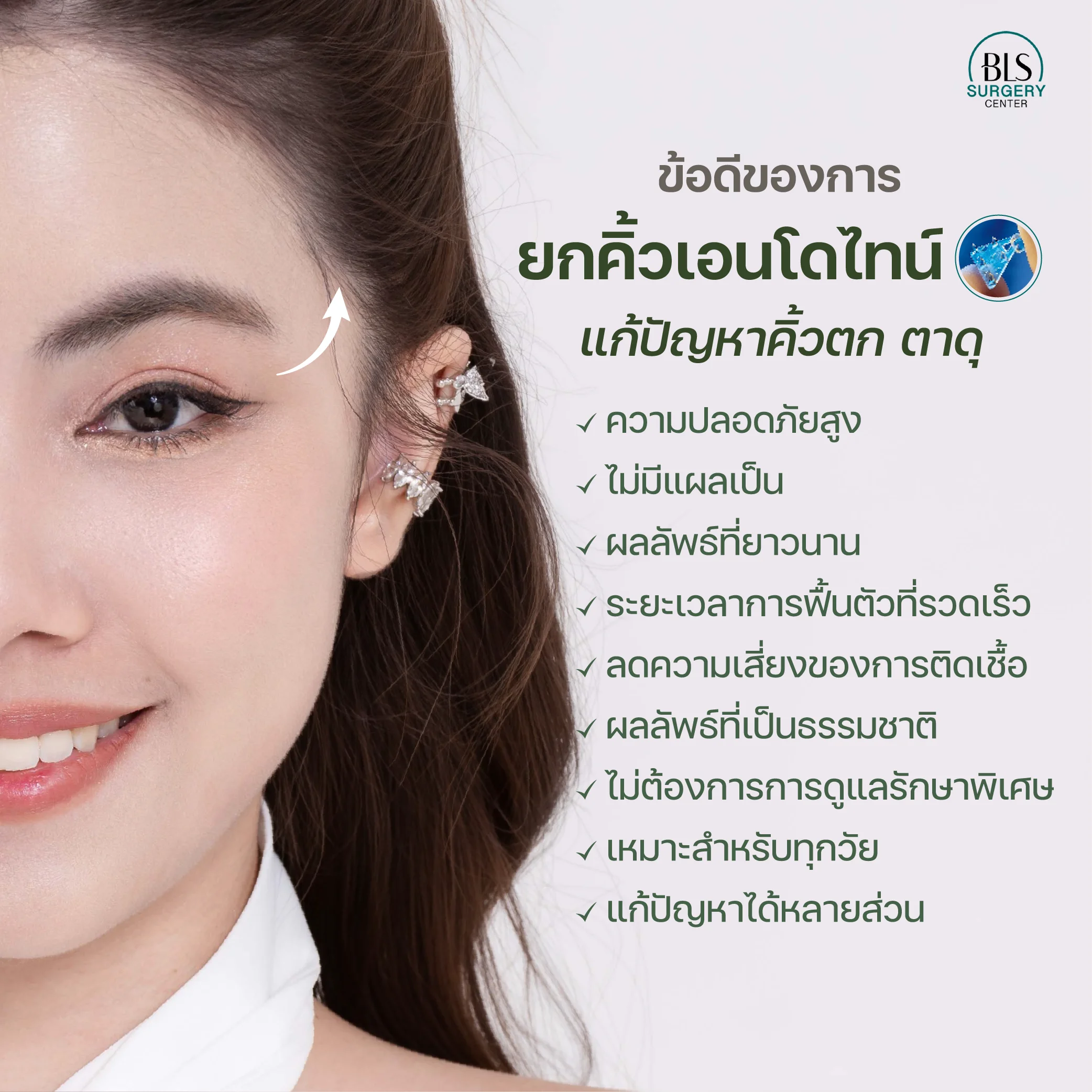 ข้อดี ยกคิ้วส่องกล้อง แผลเล็ก เจ็บน้อย