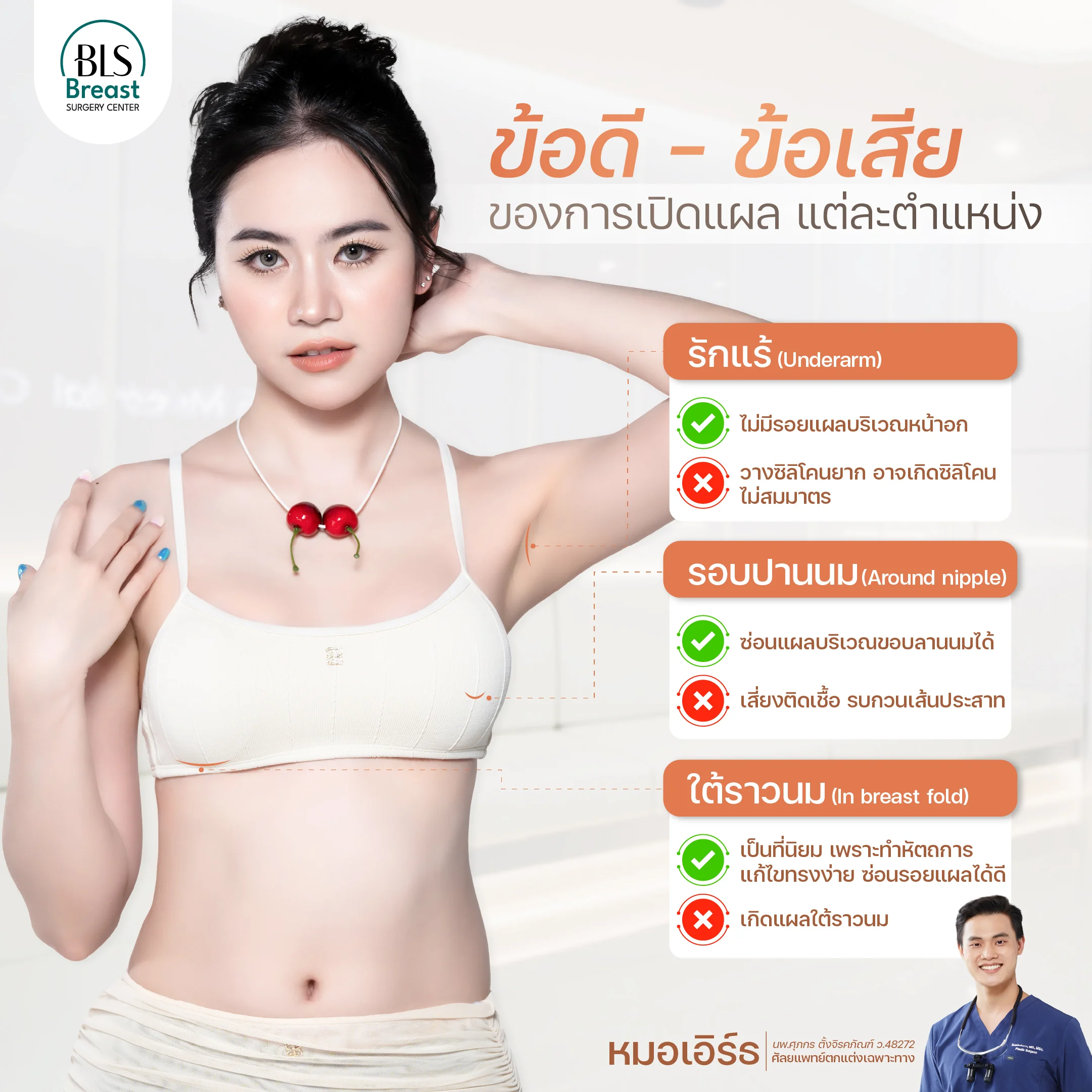 ตำแหน่งเปิดแผลเสริมหน้าอก ข้อดี-ข้อเสีย | ศัลยกรรมหน้าอก
