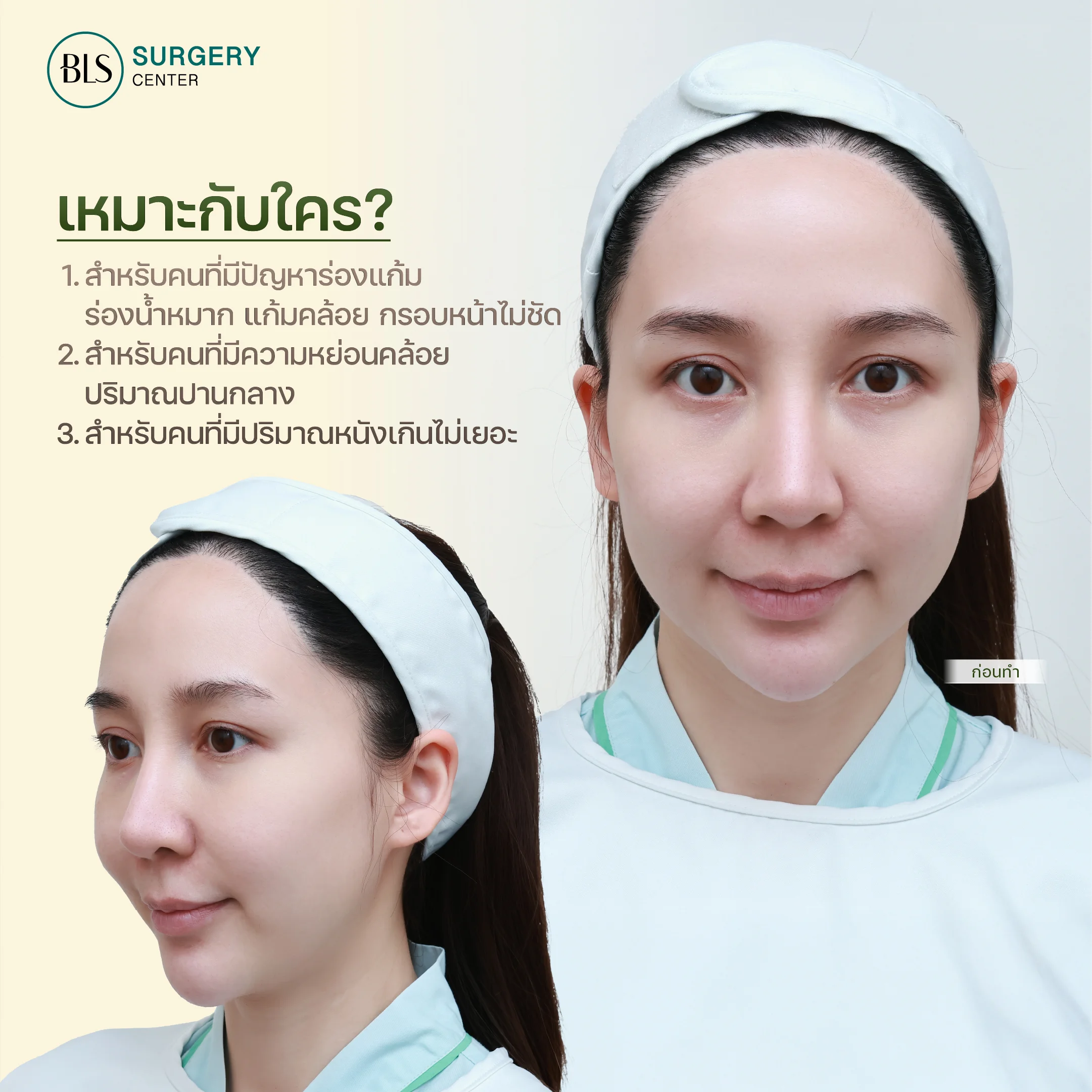 Endo-Facelift ส่องกล้องดึงหน้า