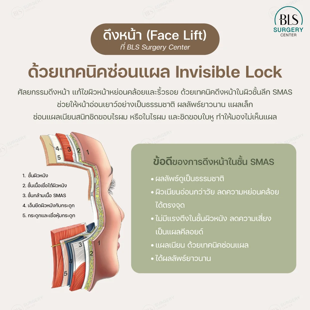 การดึงหน้า (Face Lift) ที่ BLS Surgery Center