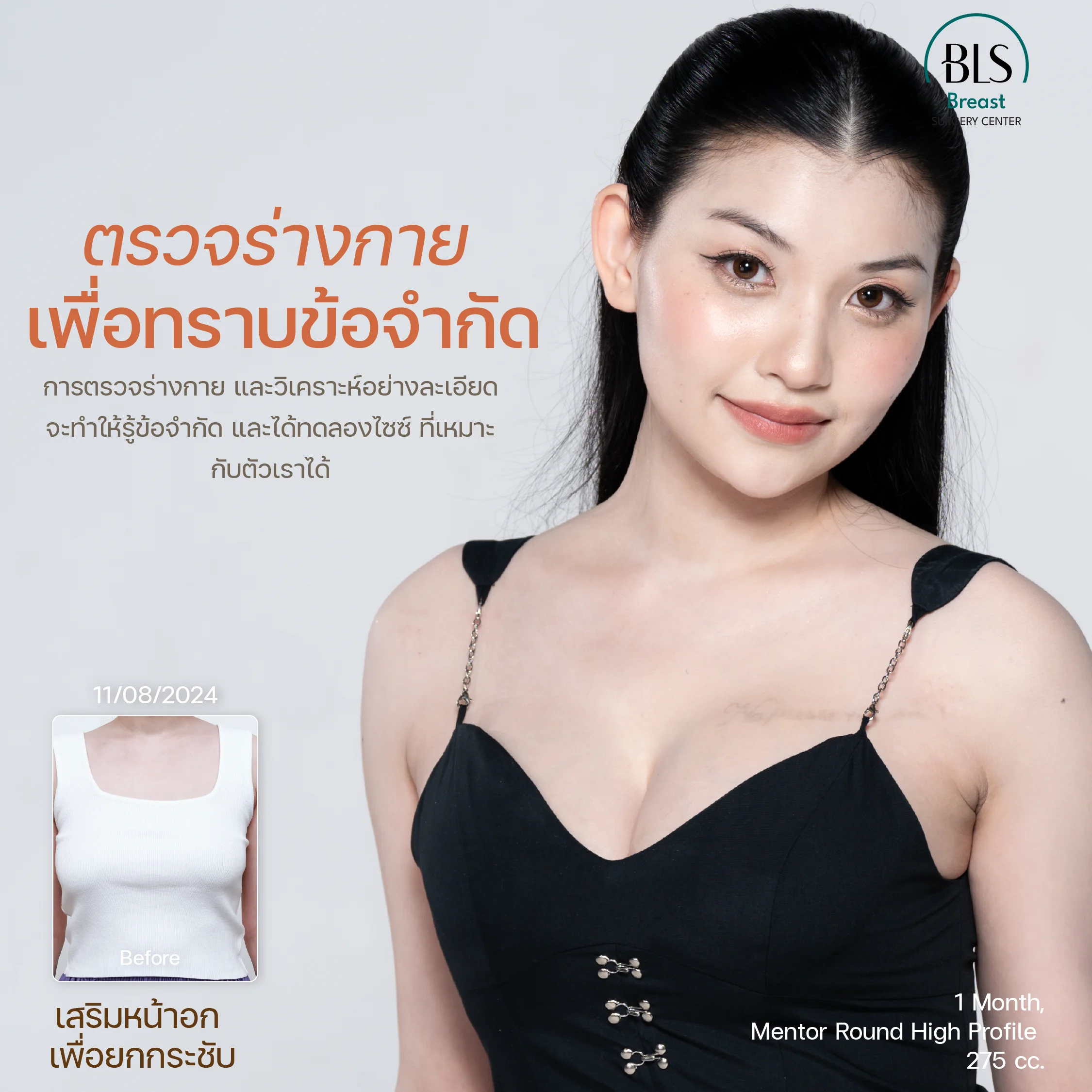 ตรวจร่างกายก่อนเสริมหน้าอก | ศัลยกรรมหน้าอก