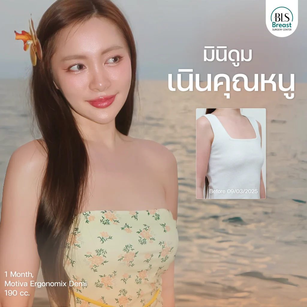 ซิลิโคน Motiva Ergonomix Demi 190 cc