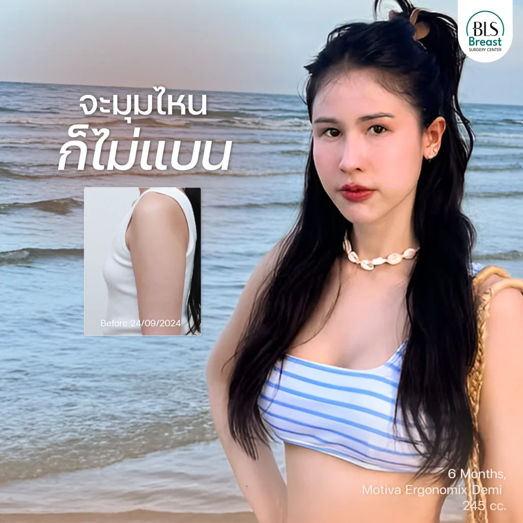 ซิลิโคน Motiva Ergonomix Demi 245 cc