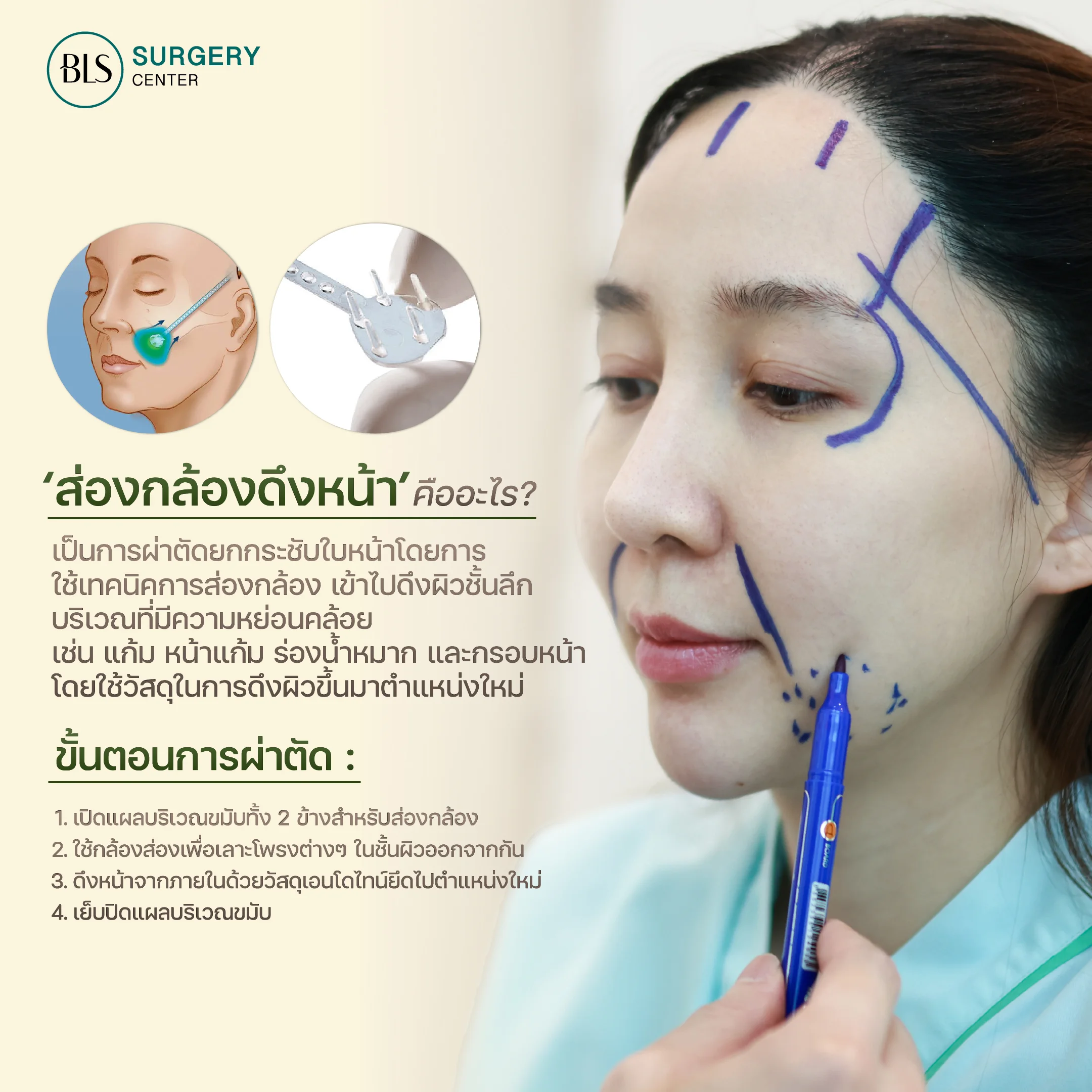 ดึงหน้าตึง ยกกระชับ