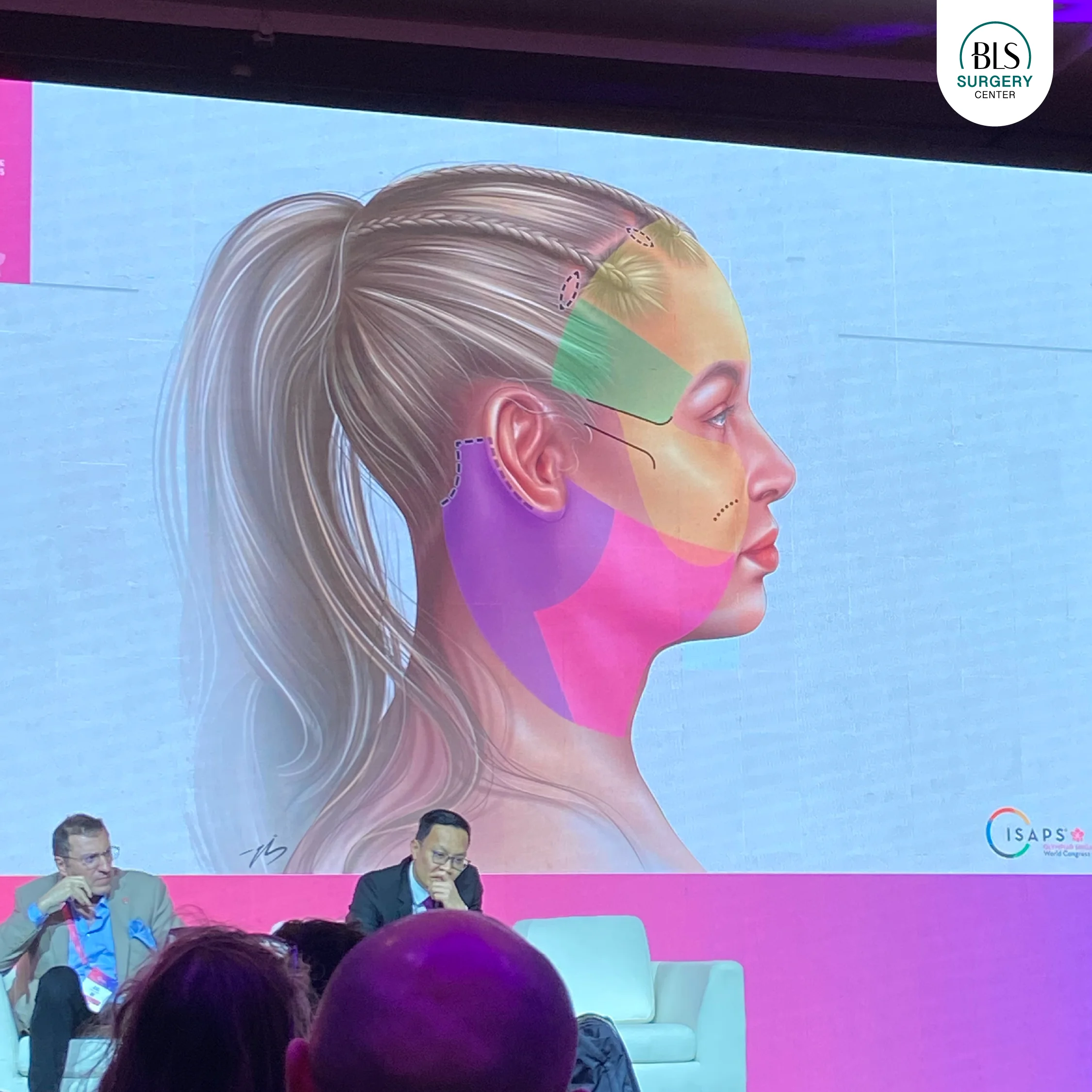 บรรยากาศงาน ISAPS 2025 