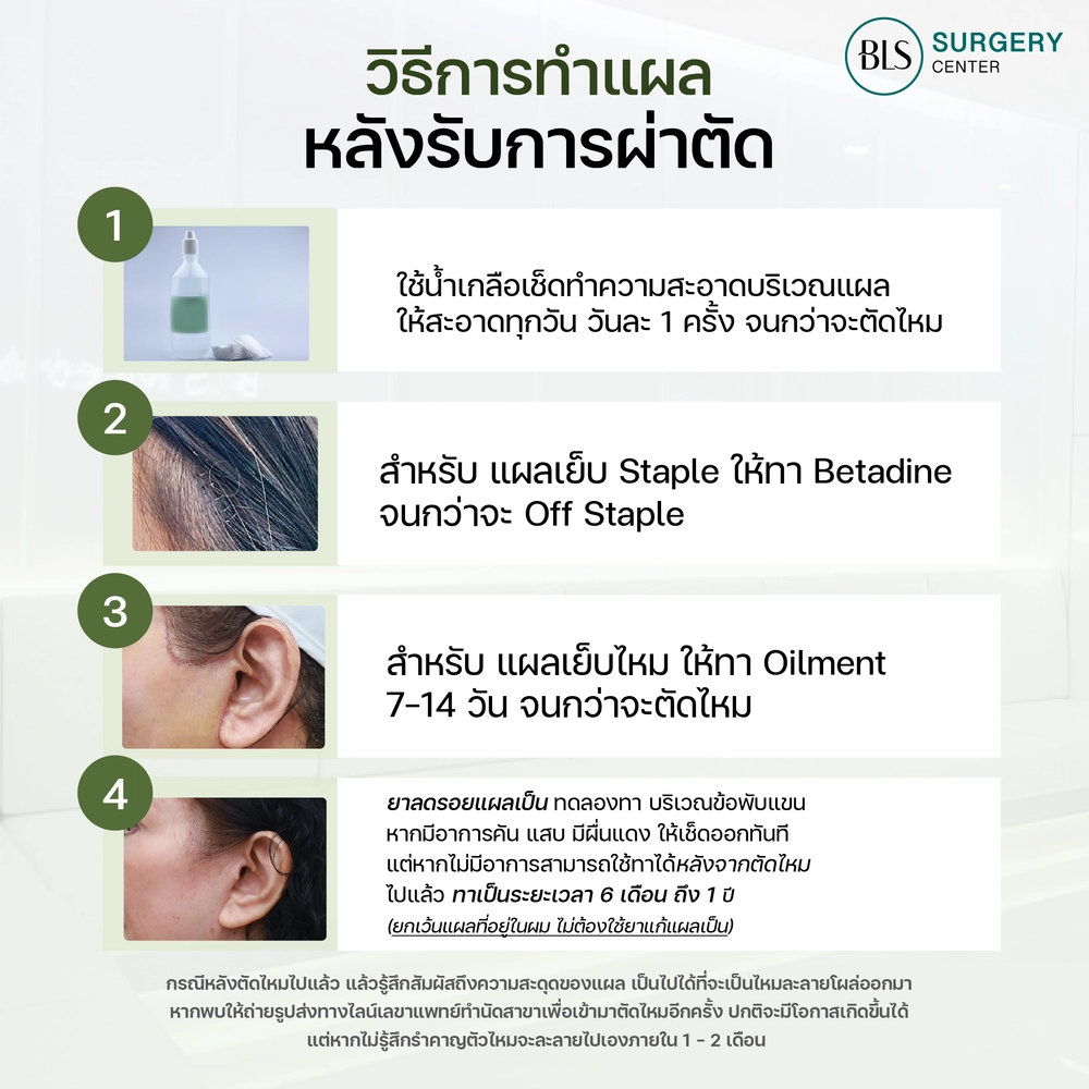 วิธีการทำแผลหลังรับการผ่าตัด