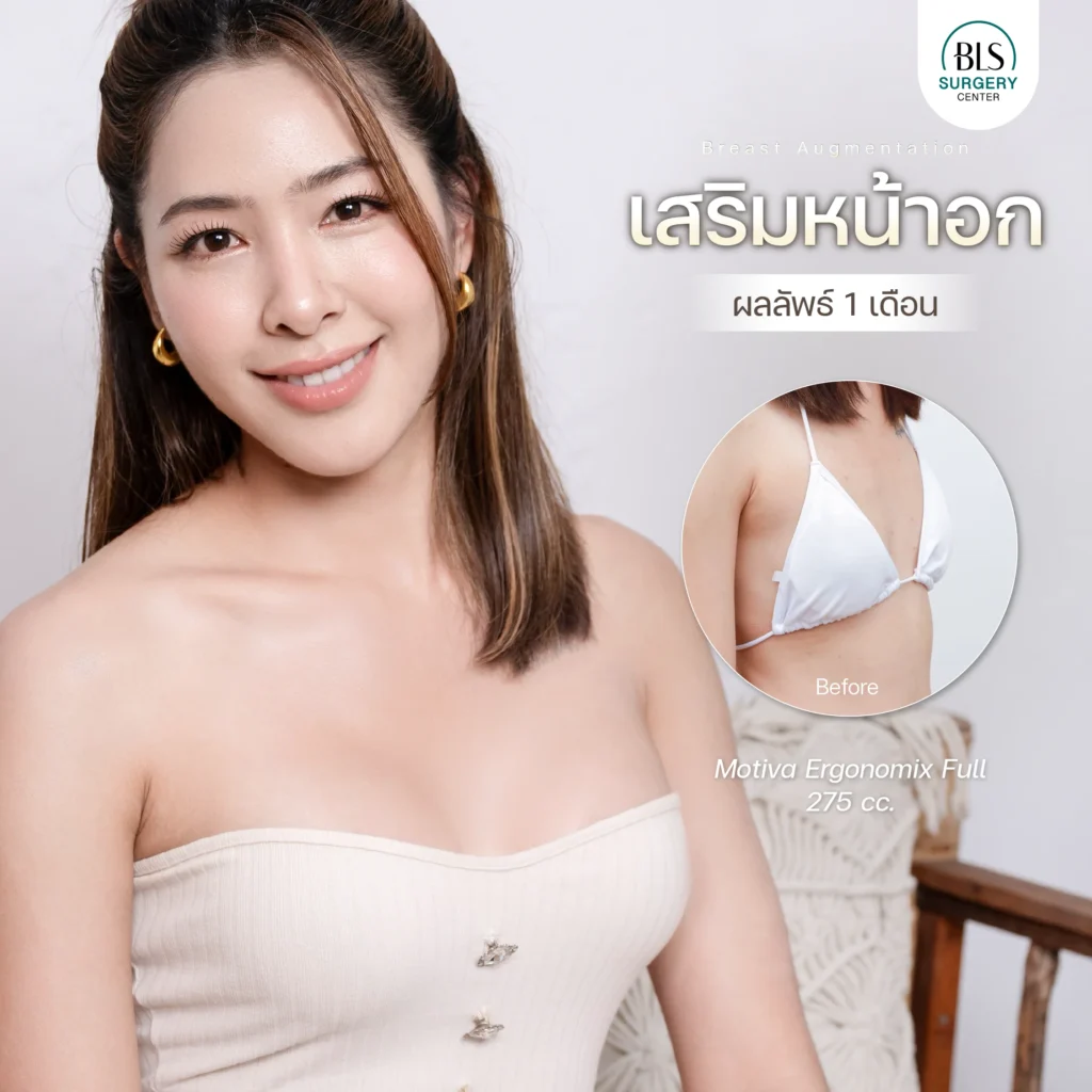 รีวิวศัลยกรรมหน้าอก ยกกระชับผิว ที่ BLS Suergery Center