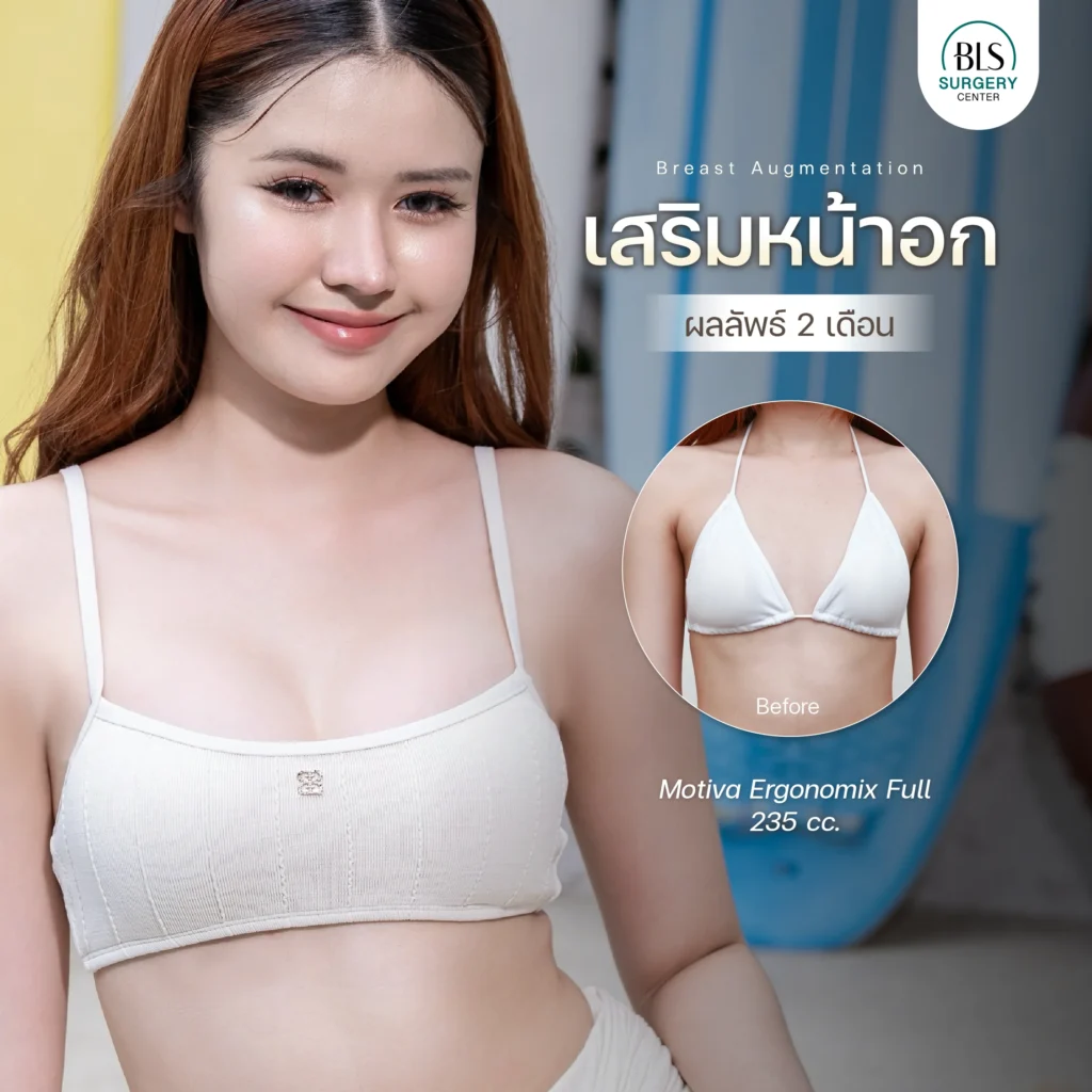 รีวิวศัลยกรรมหน้าอก ยกกระชับผิว ที่ BLS Suergery Center
