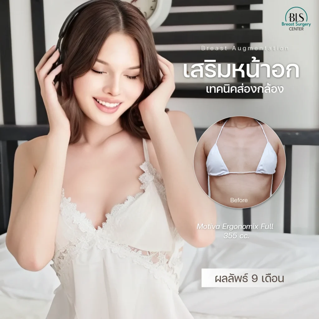รีวิวศัลยกรรมหน้าอก ยกกระชับผิว ที่ BLS Suergery Center