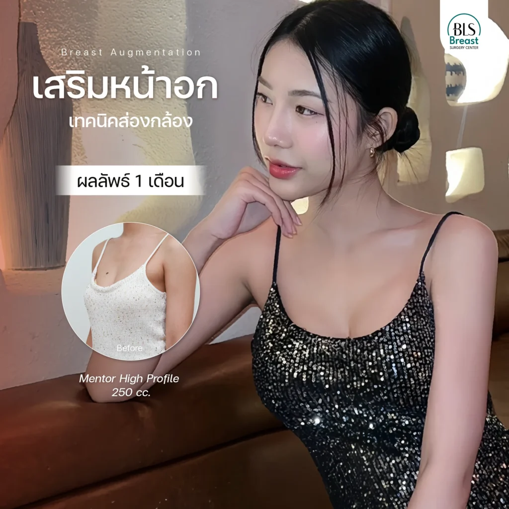 รีวิวศัลยกรรมหน้าอก ยกกระชับผิว ที่ BLS Suergery Center