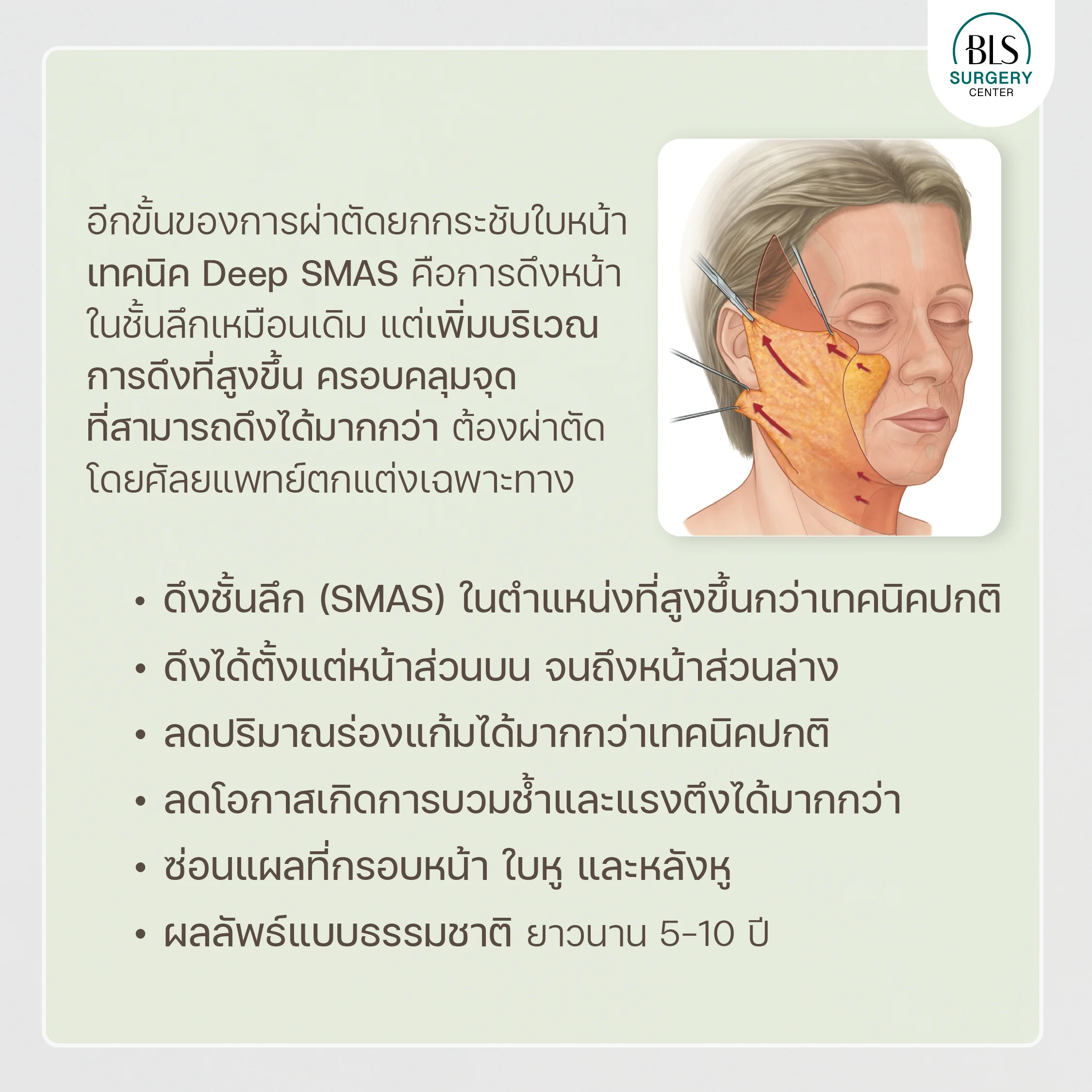 หัตถการส่องกล้องยกคิ้ว Endo-Brow Lift