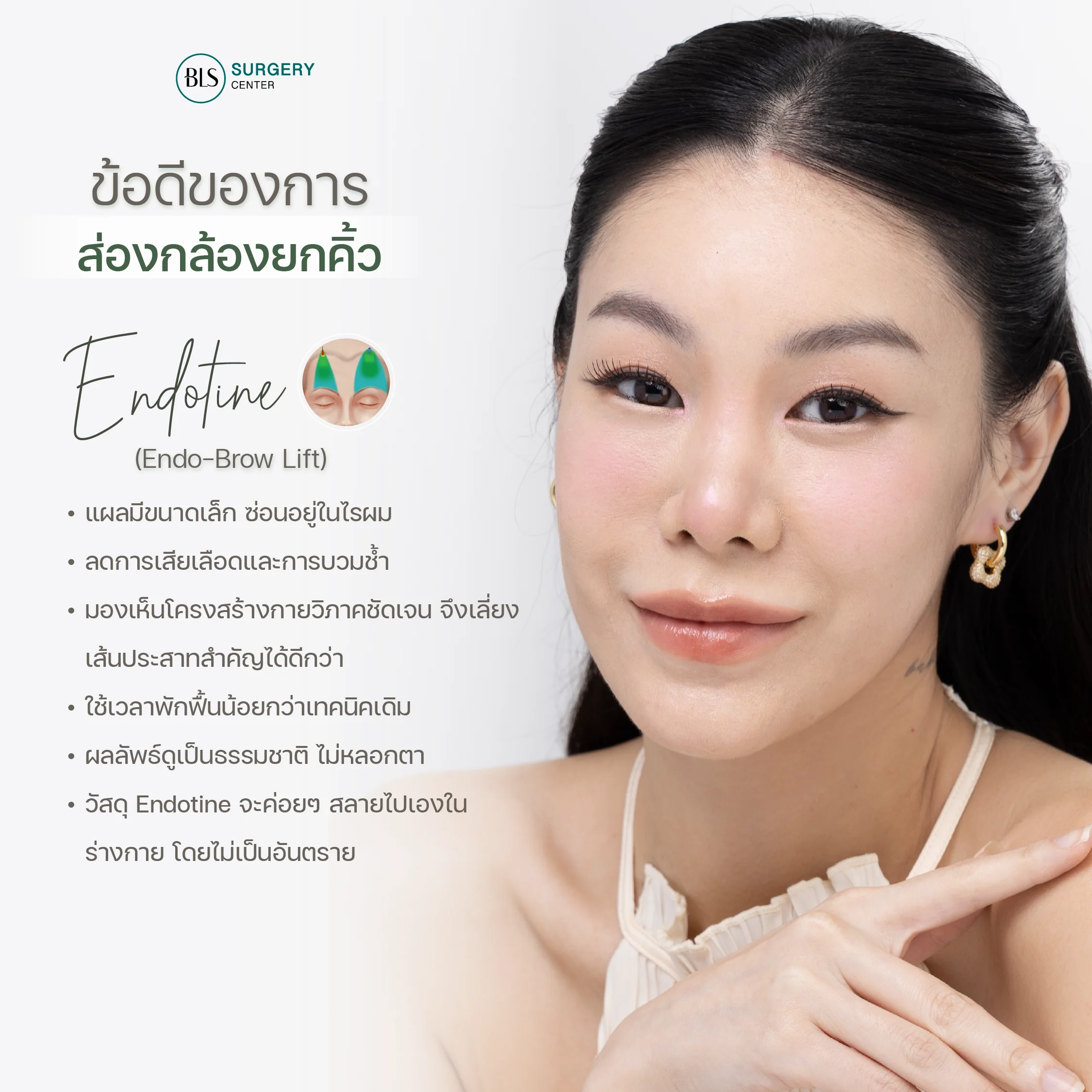 ข้อดีของเทคนิค Endo-Brow Lift ส่องกล้องยกคิ้ว