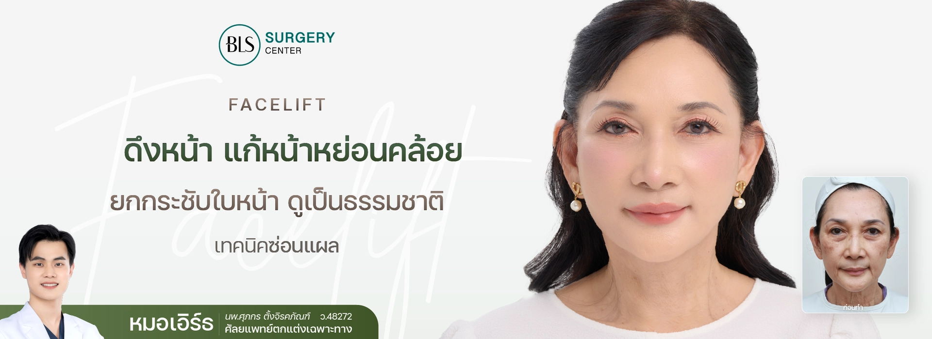ดึงหน้า แก้หน้าหย่อนคล้อย (Facelift)