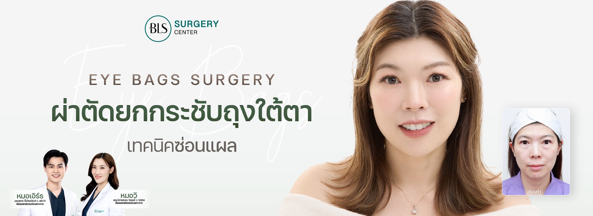 ตัดถุงใต้ตา แก้ใต้ตาบวม (Eye Bags Surgery)