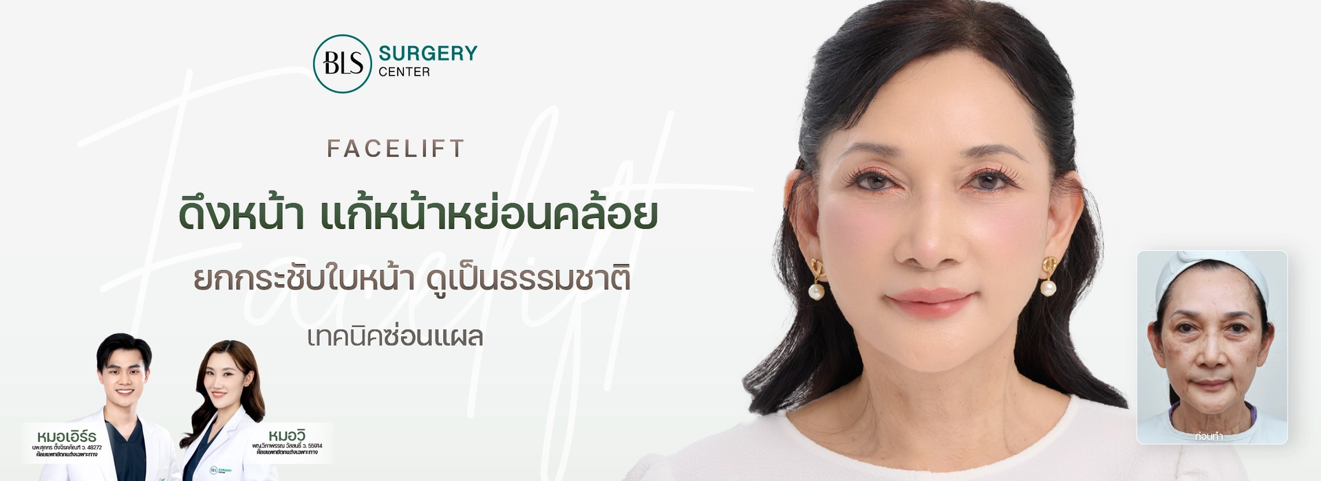 ดึงหน้า แก้หน้าหย่อนคล้อย (Facelift)