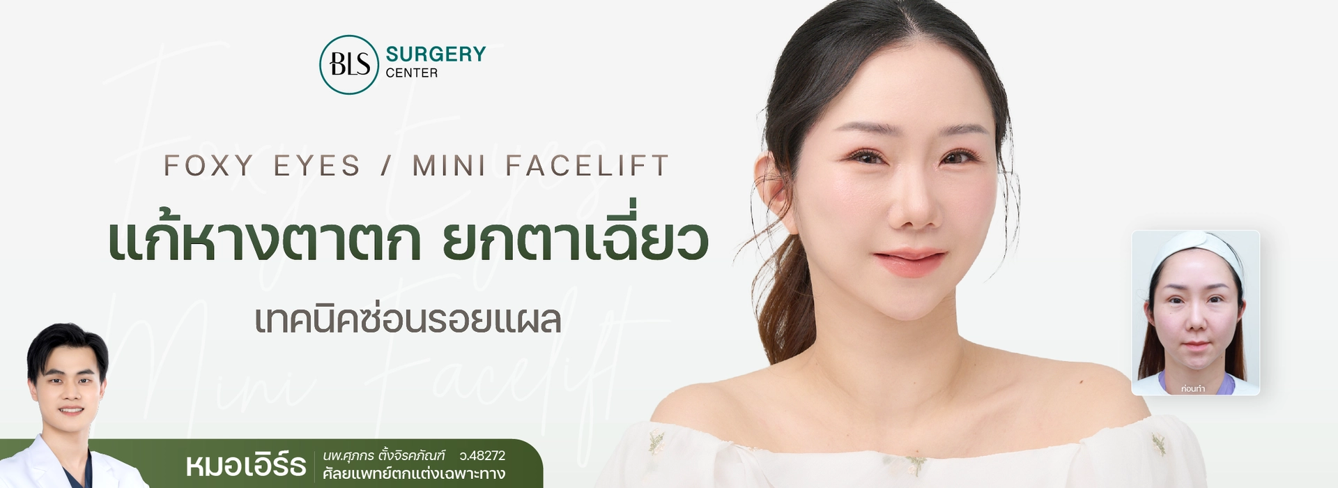 Foxy Eyes แก้หางตาตก ยกหางตาเฉี่ยว