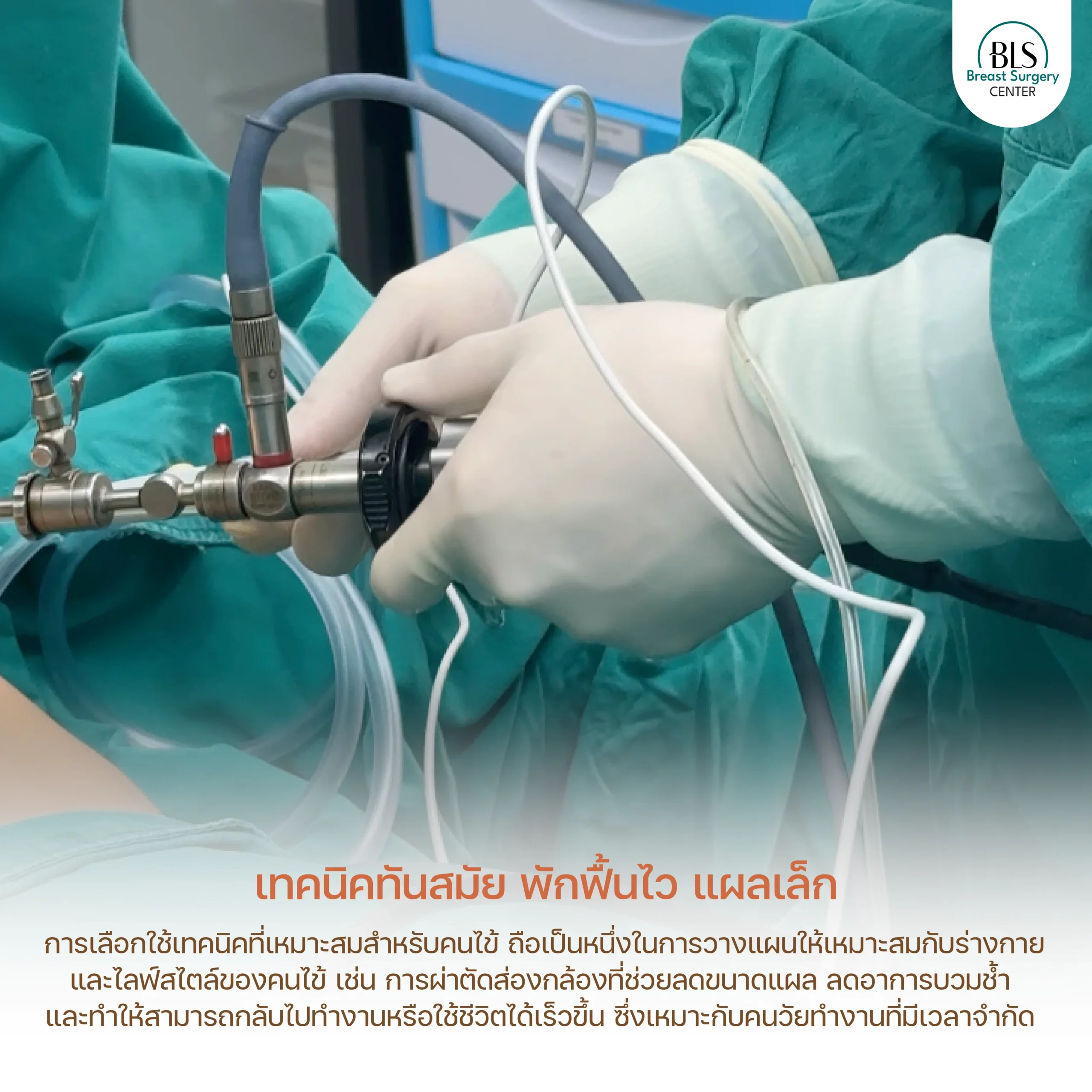 เทคนิคส่องกล้องเสริมหน้าอก (Endoscopic Breast)
