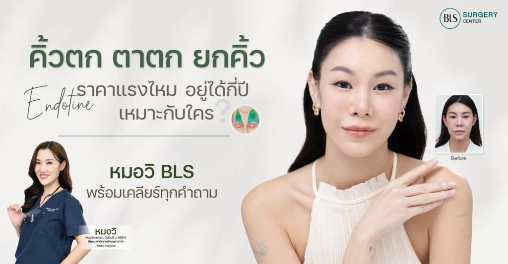 คิ้วตก ตาตก ยกคิ้ว Endotine ราคาแรงไหม? เหมาะกับใคร? อยู่ได้กี่ปี? หมอวิ BLS พร้อมเคลียร์ทุกคำถาม