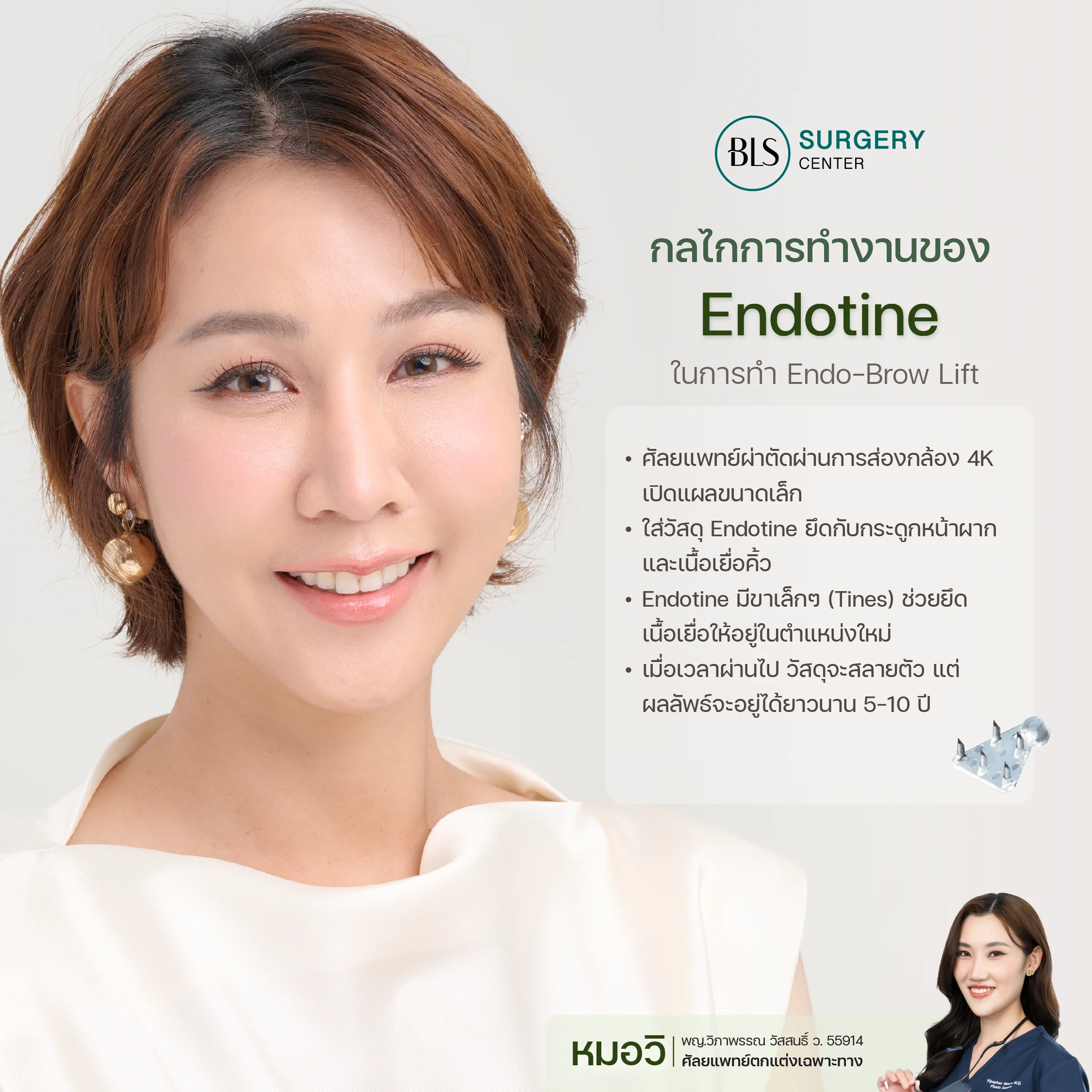 กลไกการทำงานของ Endotine ในการทำ Endo-Brow Lift
