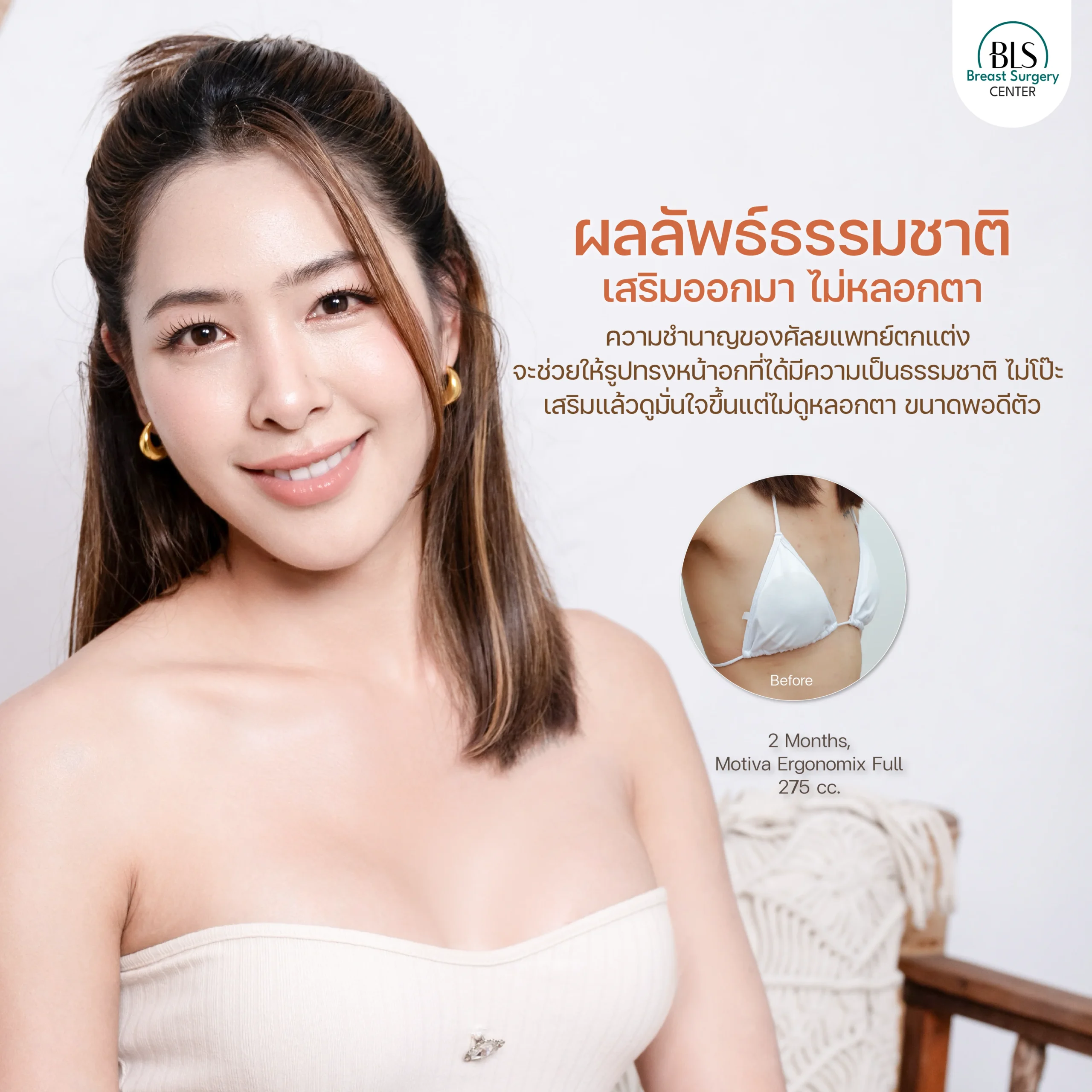 เสริมหน้าอก Motiva 275 cc ผลลัพธ์ธรรมชาติ 