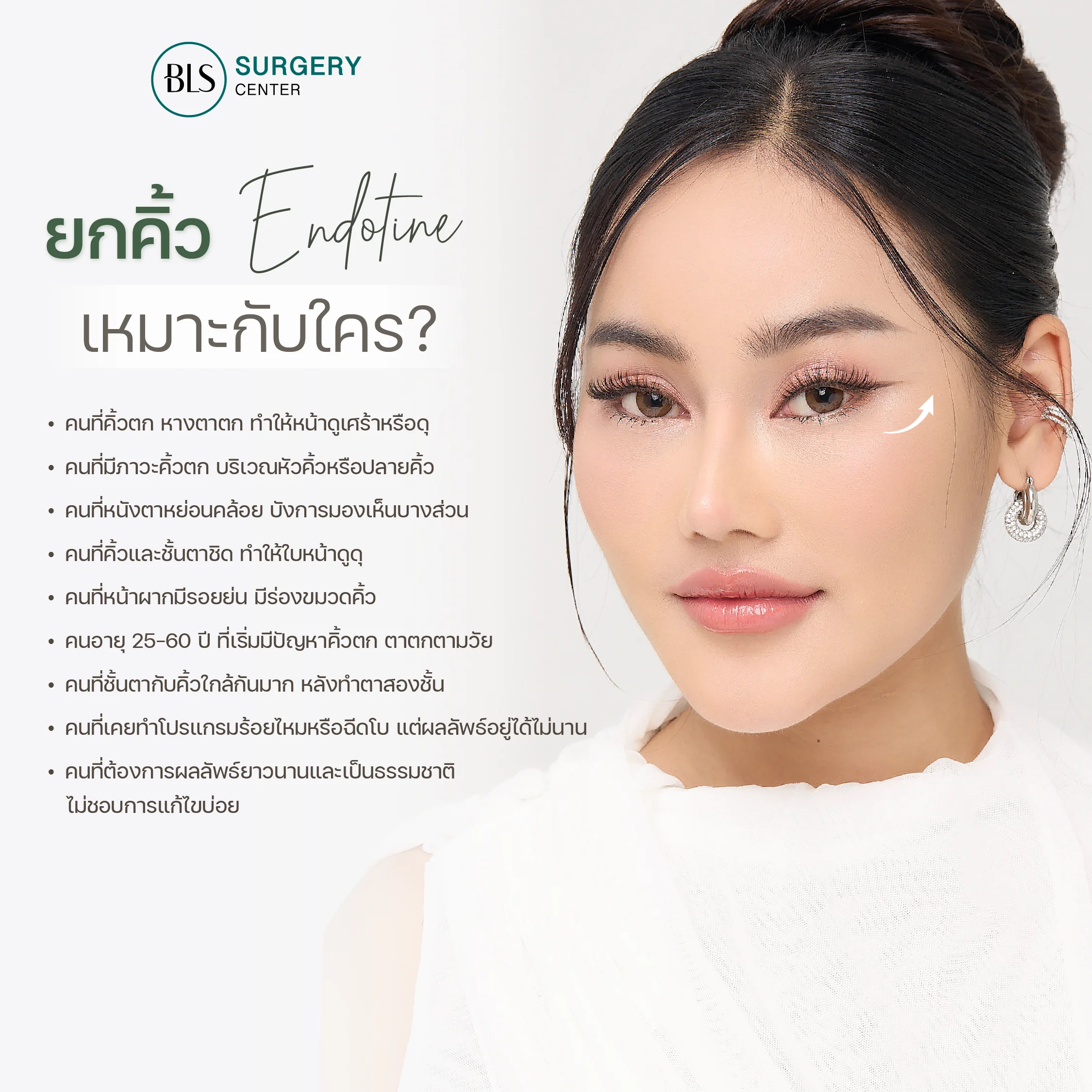 ยกคิ้ว Endotine เหมาะกับใคร