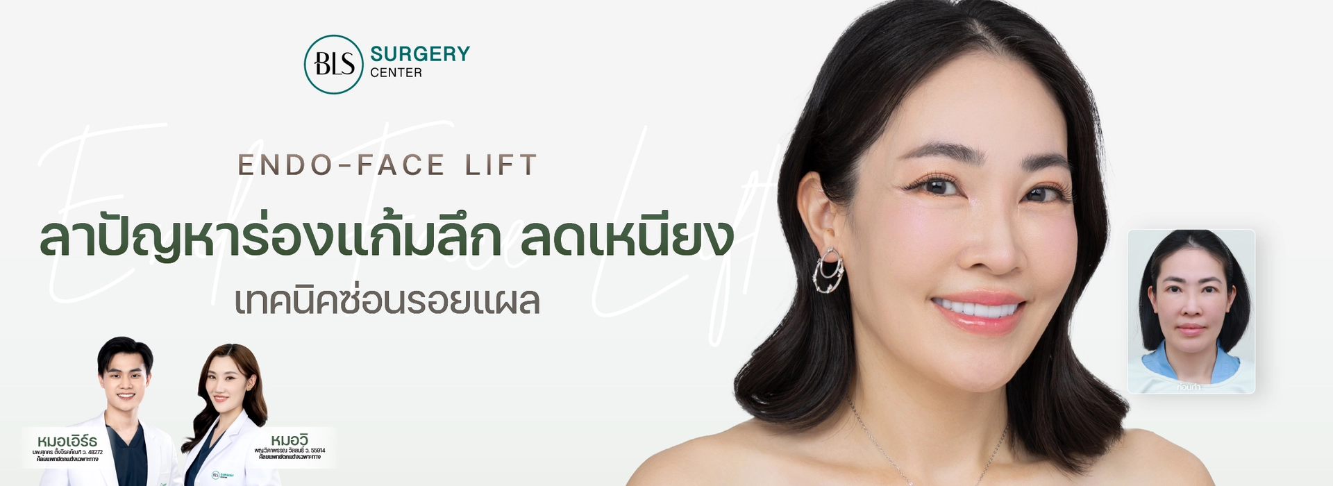 ลาปัญหา ร่องแก้มลึก ลดเหนียง ส่องกล่องดึงหน้า Endo-Face Lift