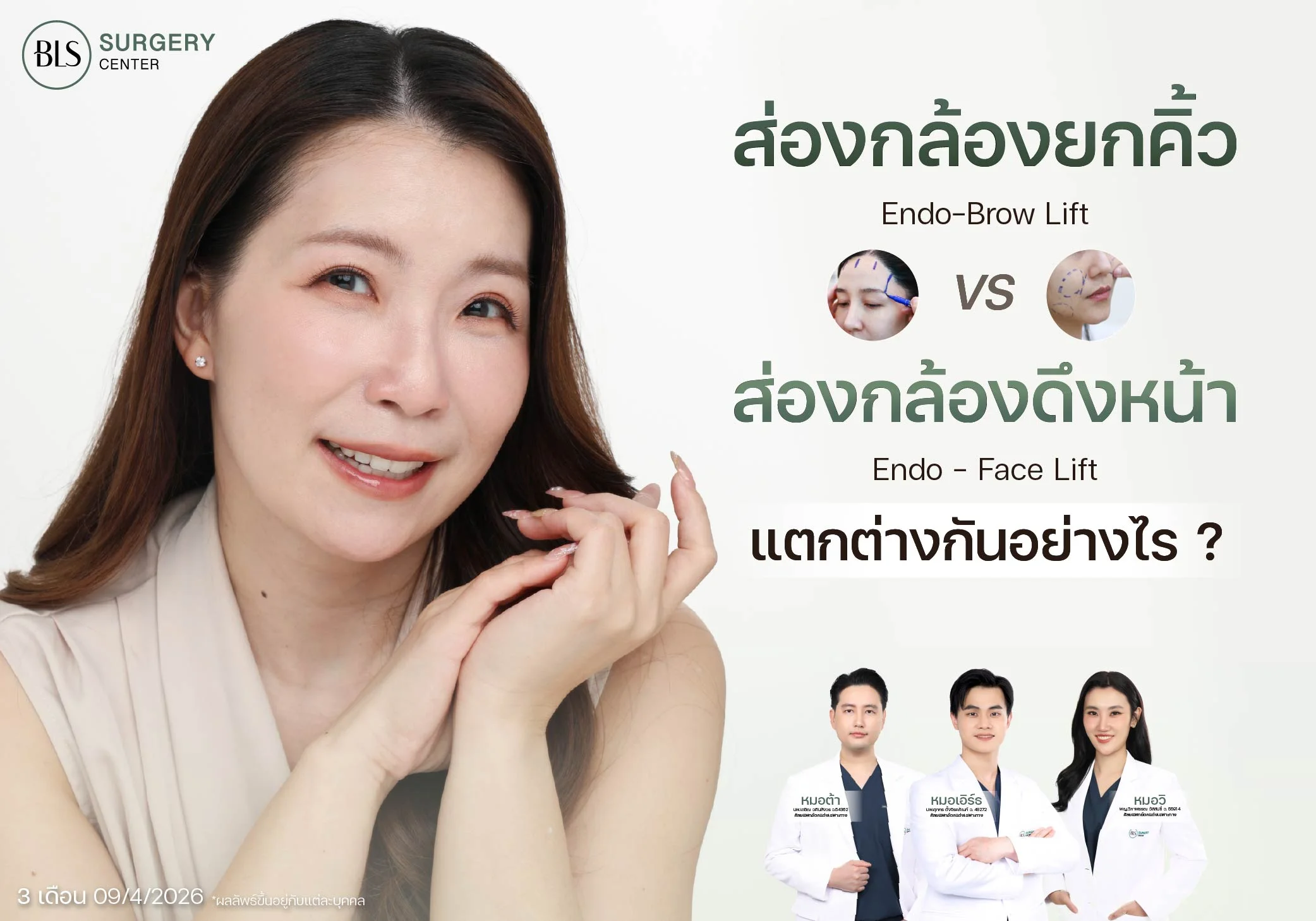 Clear Comparison: Endoscopic Face Lift vs. Endoscopic Brow Lift — What’s the Difference?