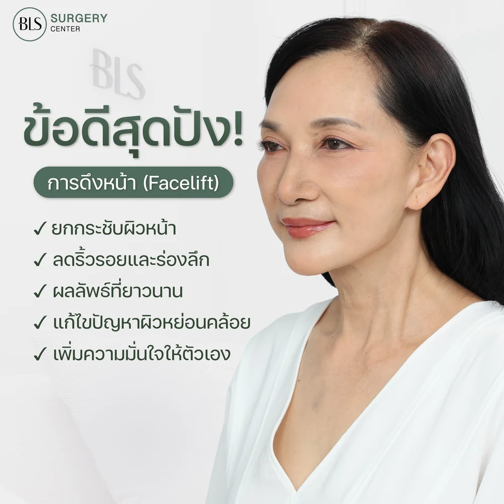 ข้อดีการดึงหน้า Facelift