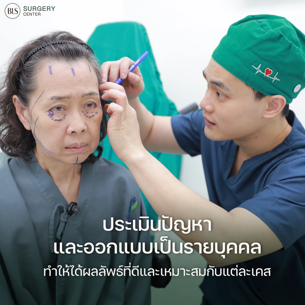 ดึงหน้า Facelift ออกแบบร่วมกับหมอเอิร์ธ Facial Expert