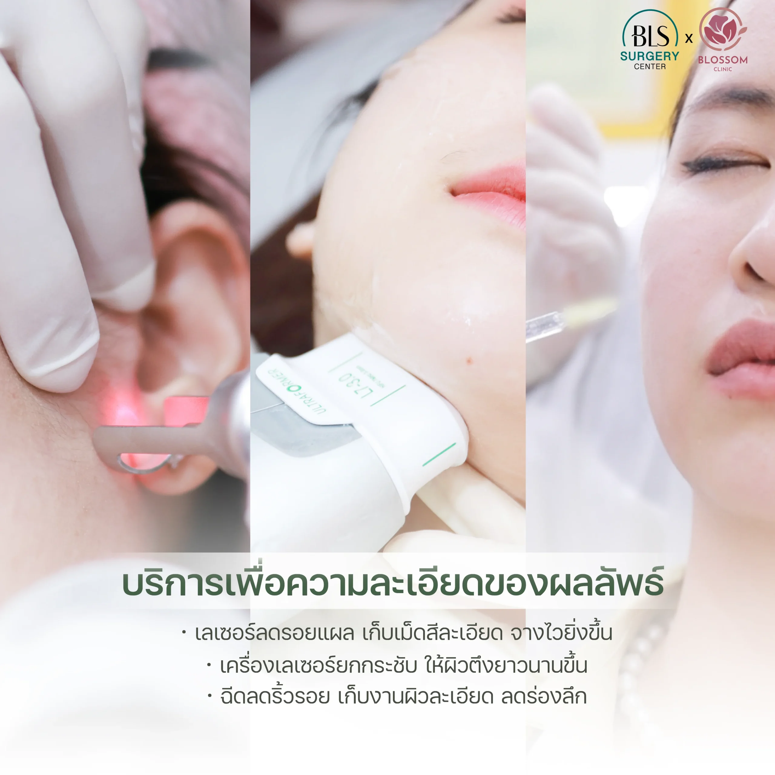 โปรแกรมยกกระชับ เพื่อยืดระยะเวลาผลลัพธ์ยาวนานขึ้น