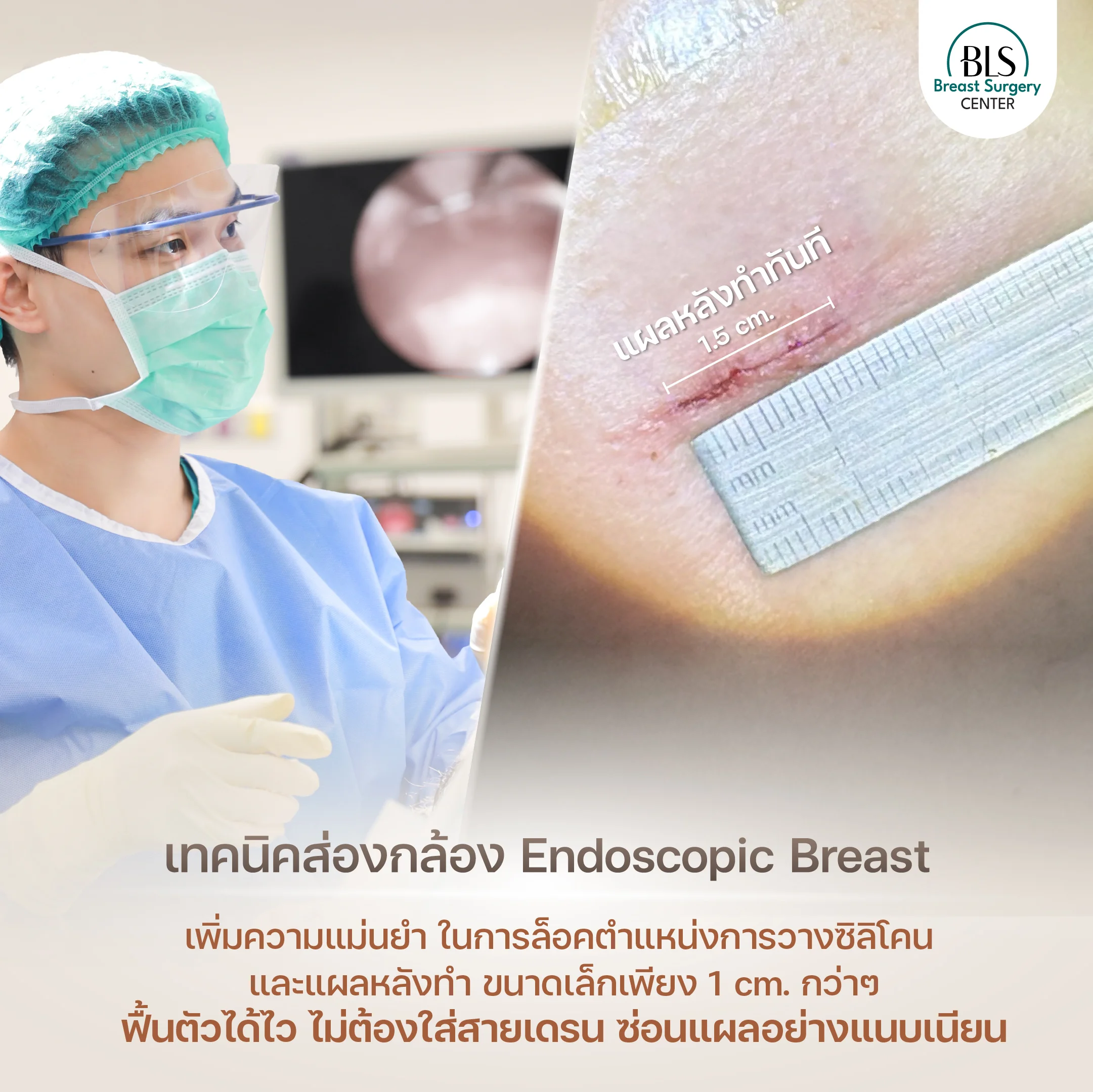 ส่องกล้องเสริมหน้าอก คืออะไร?