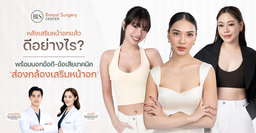 หลังเสริมหน้าอกแล้ว ดีอย่างไร? พร้อมบอกข้อดี-ข้อเสียเทคนิค "ส่องกล้องเสริมหน้าอก"
