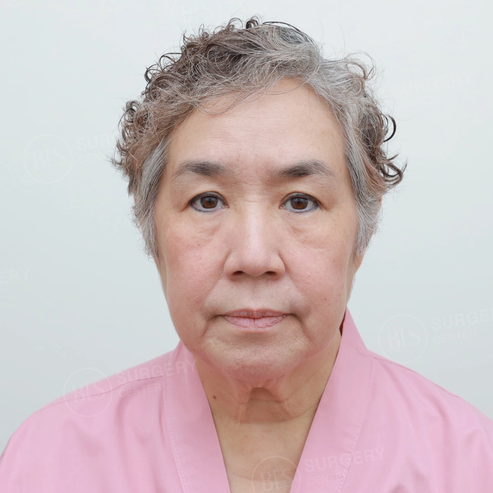 เขื่อนดนัย' สุดประทับใจ หลังพา 'แม่ตั้ม' ศัลยกรรมครั้งแรก ที่ BLS