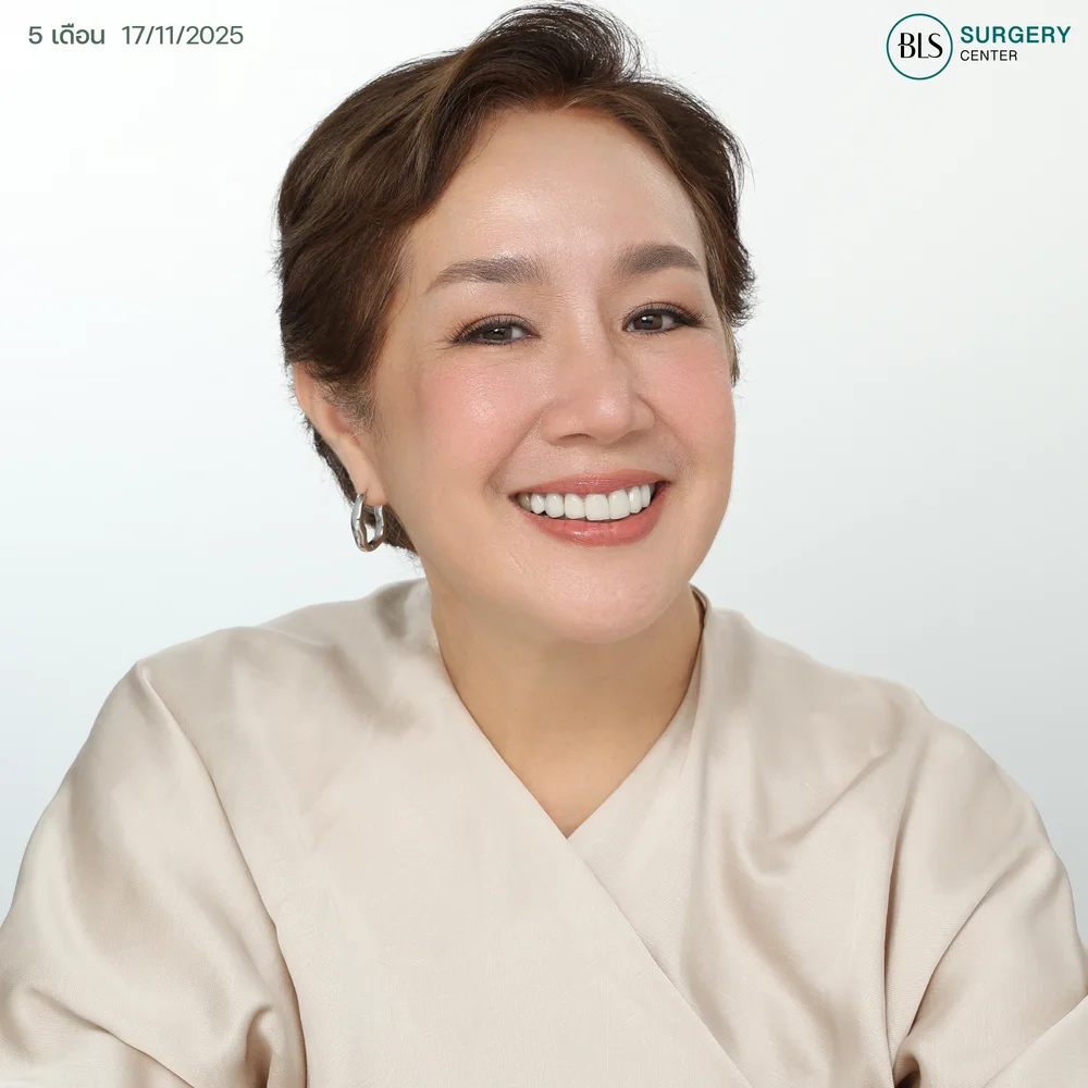 BLS ดึงหน้า ราคาเท่าไหร่ ประเมินกับคุณหมอก่อนได้