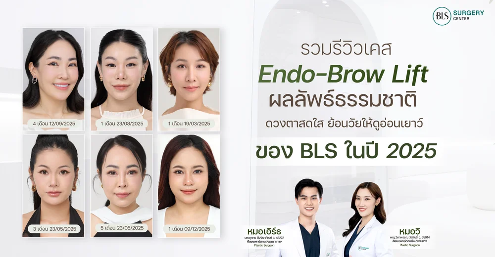 รวมเคส Endotine ผลลัพธ์ธรรมชาติ ดวงตาสดใส ย้อนวัยให้ดูอ่อนเยาว์ ของ BLS ในปี 2025