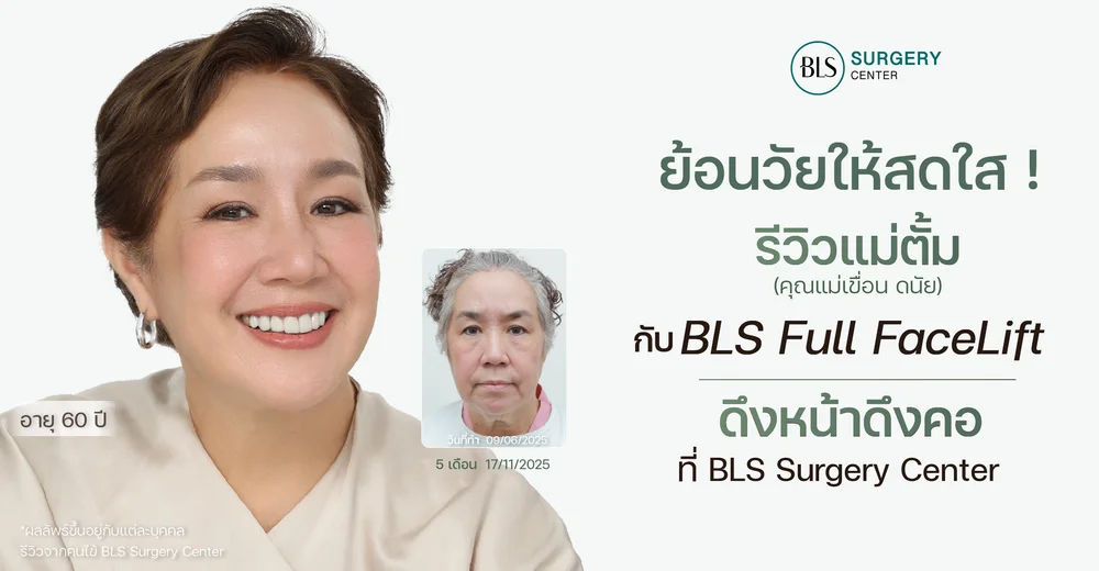 ย้อนวัยให้สดใส! รีวิวแม่ตั้ม (คุณแม่เขื่อน ดนัย) กับ BLS Full Facelift ดึงหน้า ดึงคอ ที่ BLS Surgery Center
