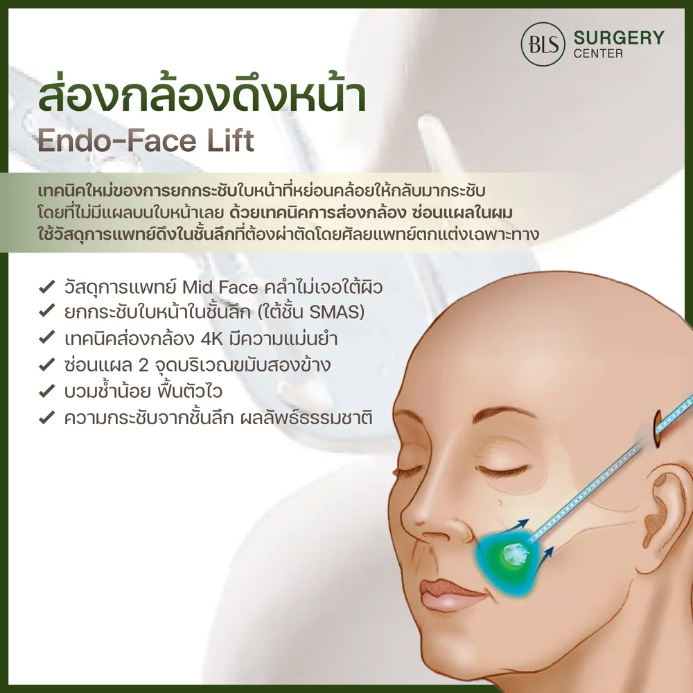 ดึงหน้า เอนโดไทน์ช่วยอะไร?