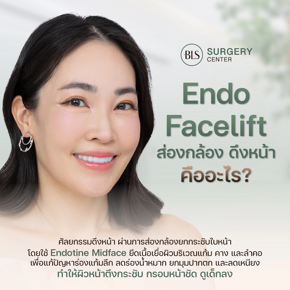 Endo-Face Lift คืออะไร? ช่วยแก้ปัญหา ร่องแก้มลึก ลดเหนียงได้หรือไม่?