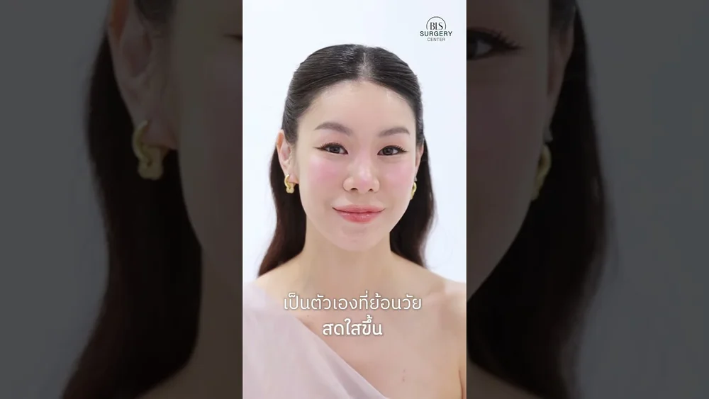 Endo-Brow Lift ส่องกล้องยกคิ้ว 