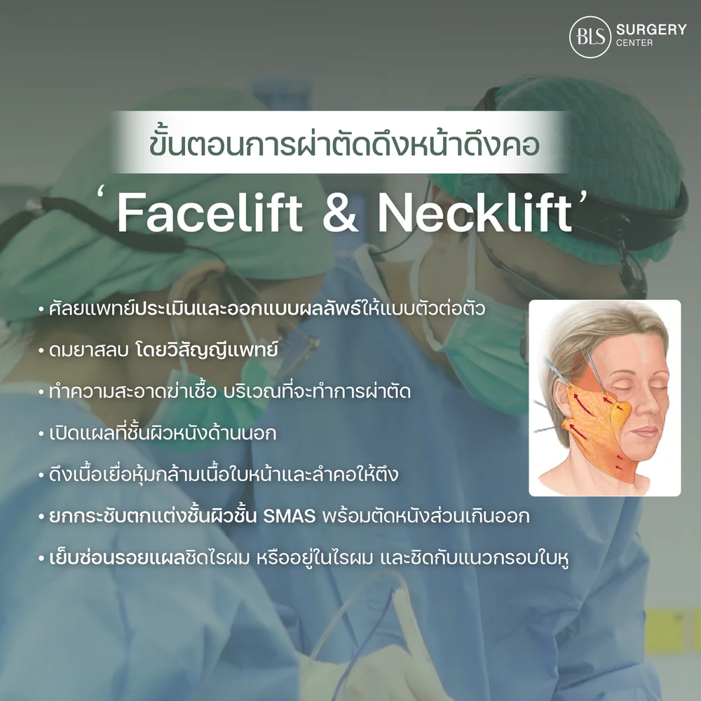 Overview of the Facelift and Necklift procedure