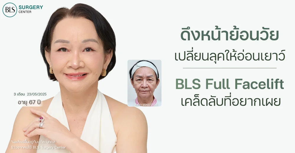 ดึงหน้าย้อนวัย เปลี่ยนลุคให้อ่อนเยาว์ BLS Full Facelift เคล็ดลับที่อยากเผย