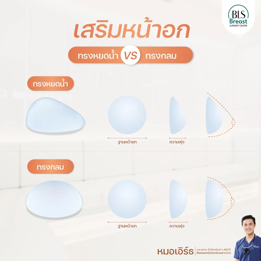 การเสริมหน้าอก ทรงหยดน้ำ VS ทรงกลมกึ่งหยดน้ำ