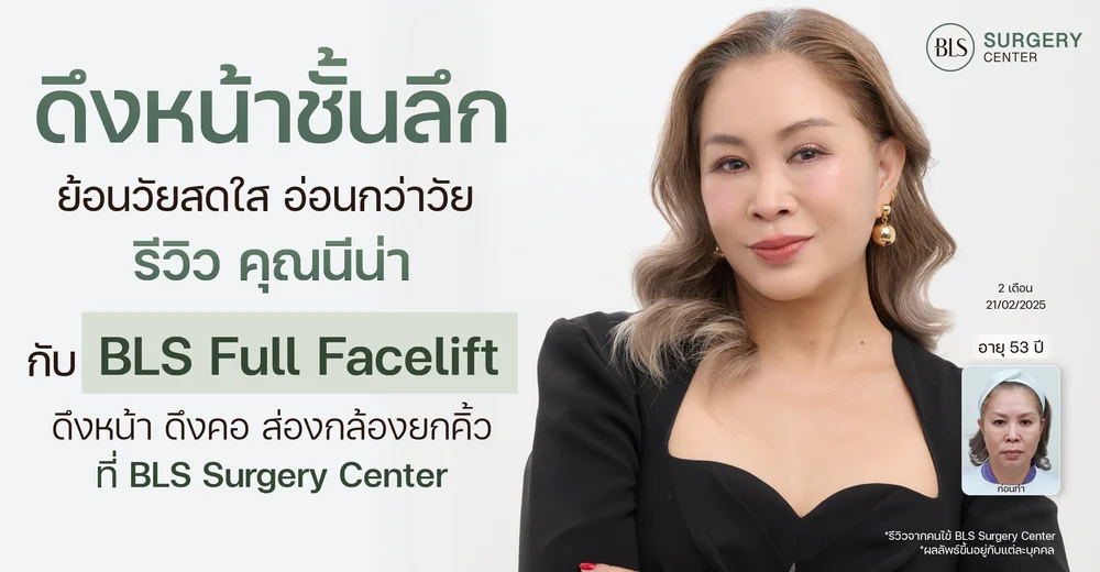 ดึงหน้าชั้นลึกผลลัพธ์ธรรมชาติ สดใส อ่อนกว่าวัย รีวิวคุณนีน่า กับ BLS Full Facelift ดึงหน้า ดึงคอ ส่องกล้องยกคิ้ว ที่ BLS Surgery Center