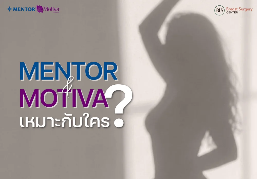 ซิลิโคน Mentor vs Motiva ใครเหมาะกับแบบไหน ?
