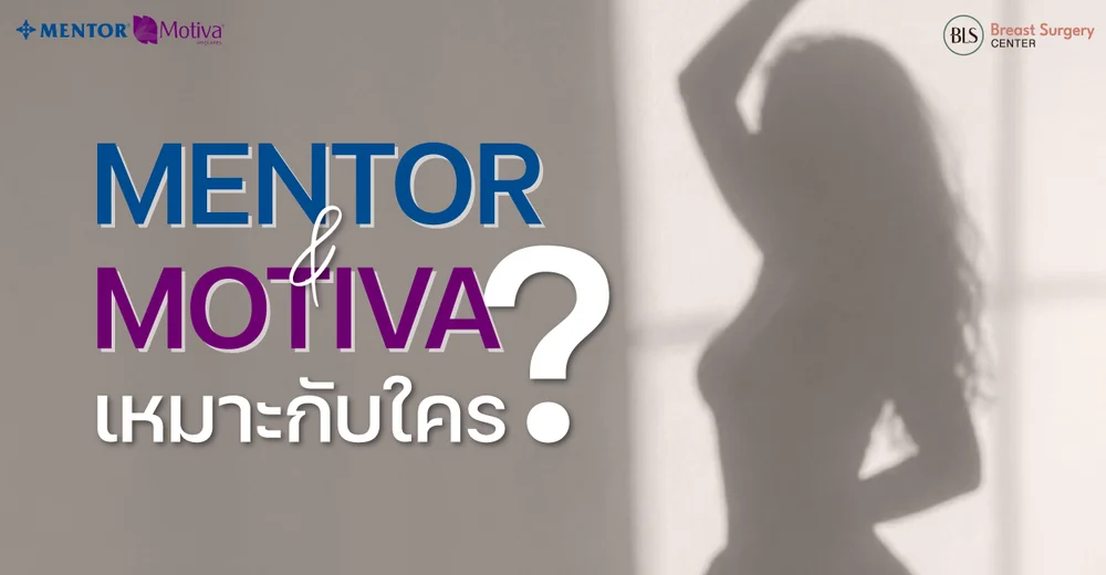 ซิลิโคน Mentor vs Motiva ใครเหมาะกับแบบไหน ?