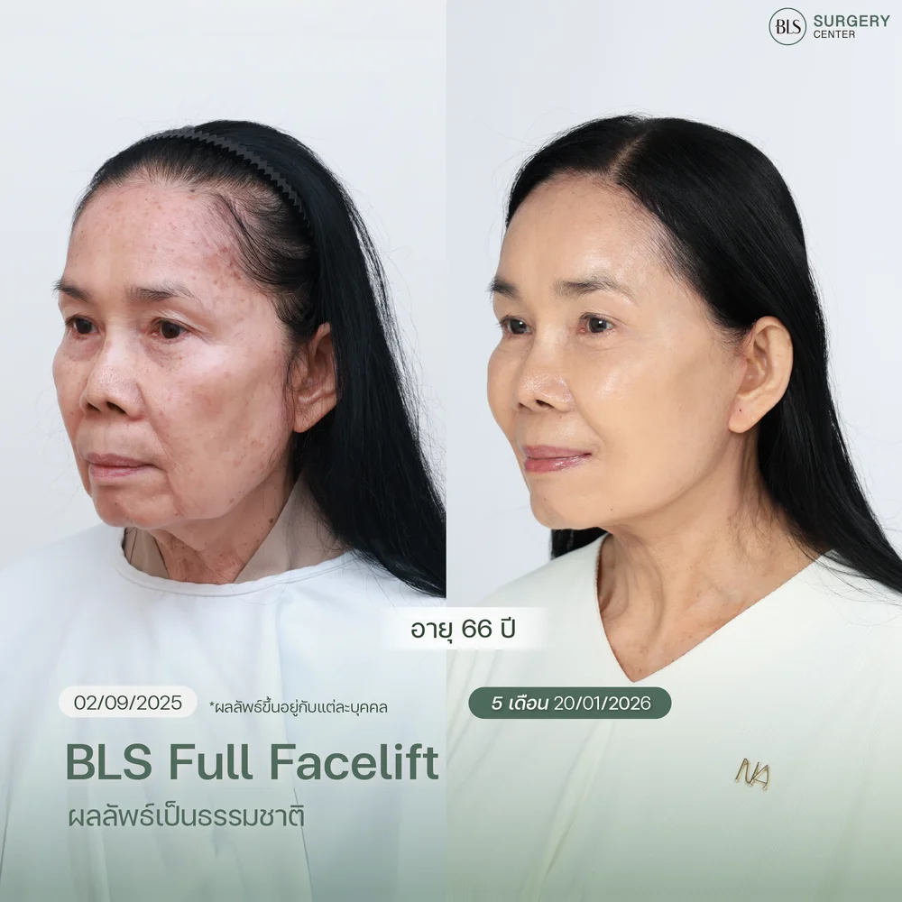 ศัลยกรรมใบหน้ามีอะไรบ้าง และช่วยอะไร