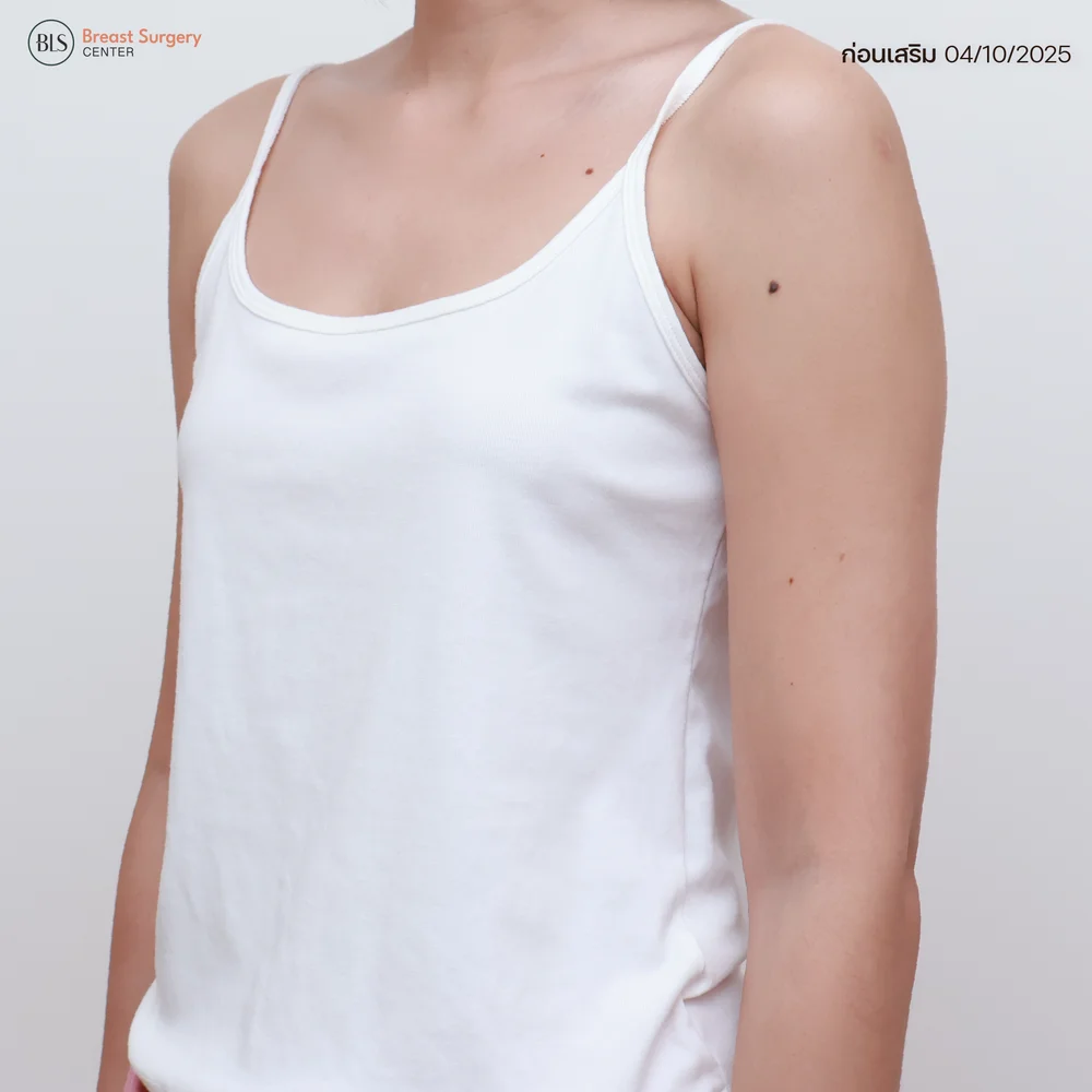 รีวิวคลินิกเสริมหน้าอกที่ปลอดภัยและราคาไม่แพง